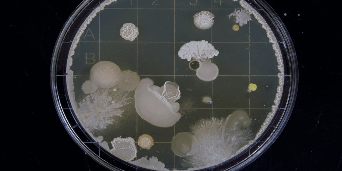 Microalgae: The Future of Protein