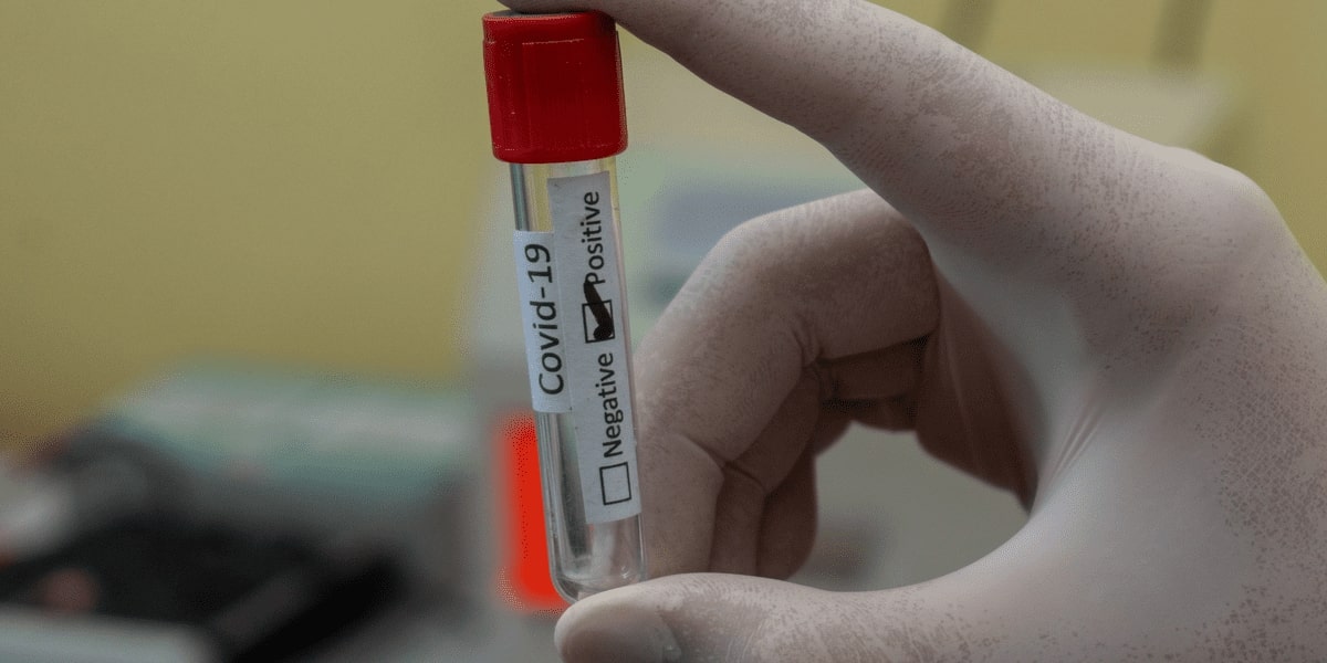 Outsourcing of IVD Instrument Design Is Now A Must